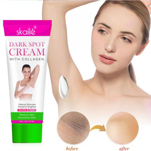 Creme removedor de manchas escuras de colágeno