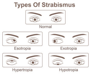 Os tapa-olhos são bons para os olhos?
